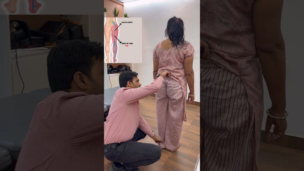 Chiropractic Relief for Sciatica Pain 🌟