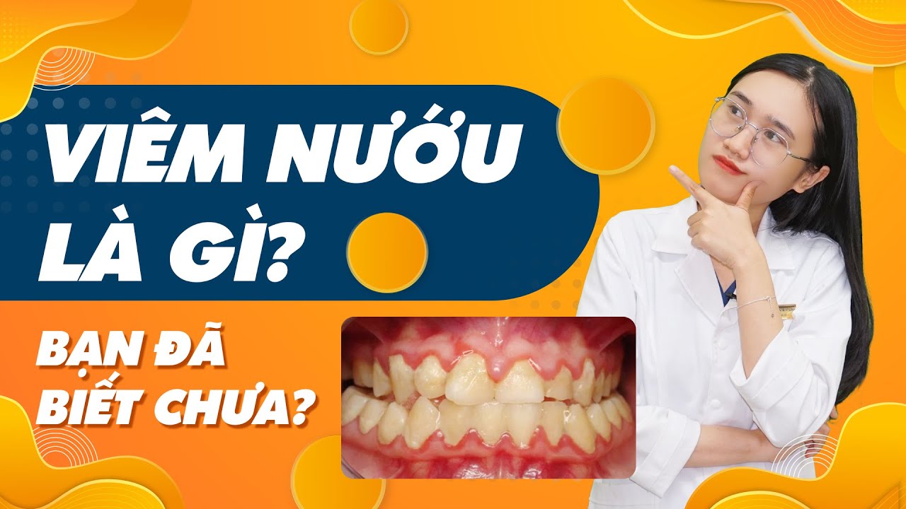 Viêm Nướu Là Gì? Bạn Đã Biết Chưa? | Nam Bùi