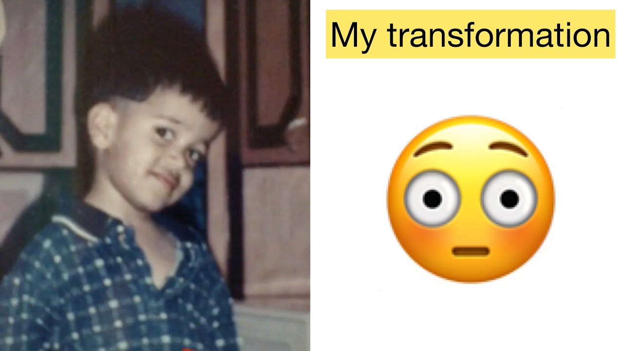 My Transformation Journey: Gaining Weight πͺ