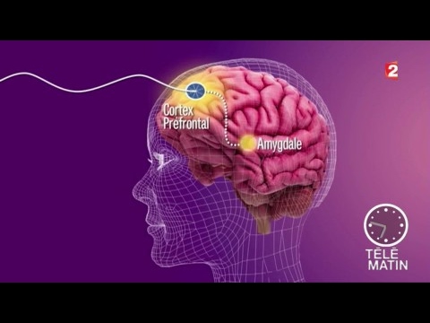 Traitement cérébral pour lutter contre la fraude 🧠