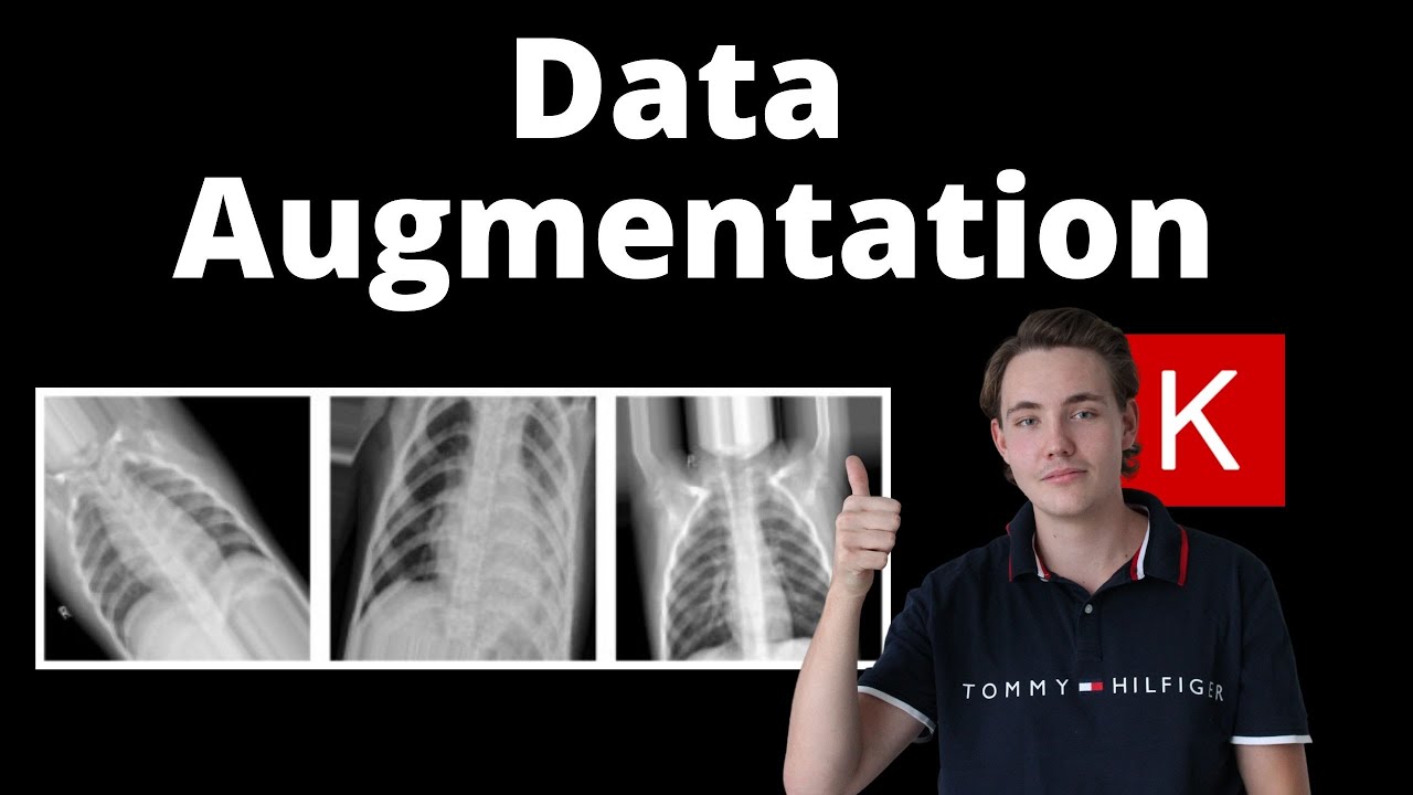 Data Augmentation Techniques in Neural Networks with Keras and TensorFlow