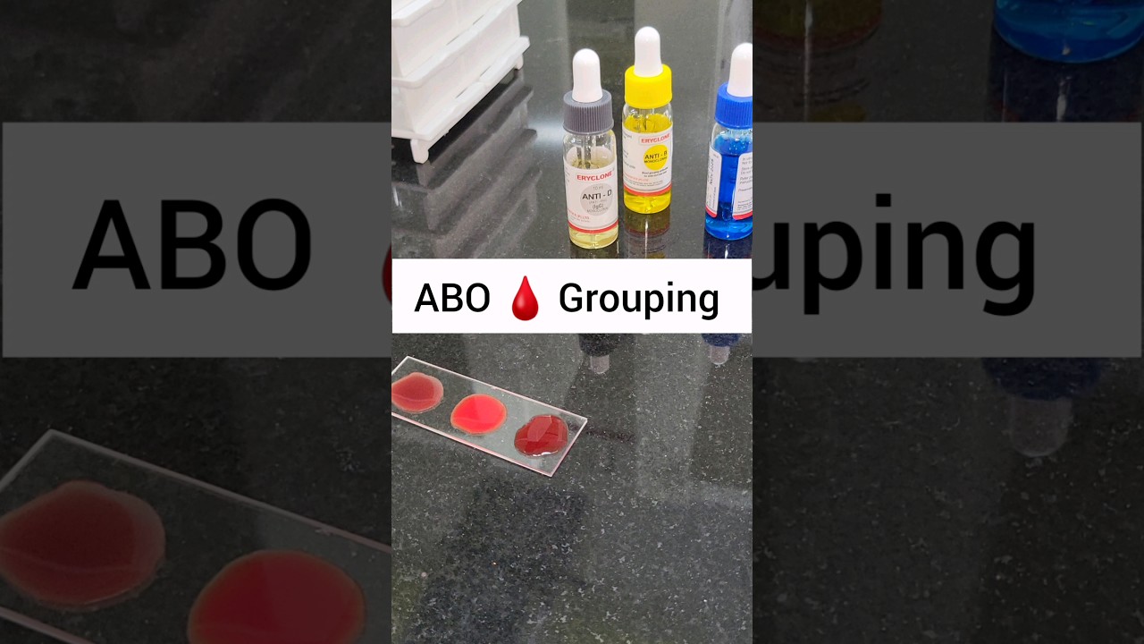 ABO Blood Grouping - Step-by-Step MBBS Pathology Practical | Blood Typing #Shorts
