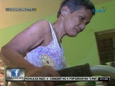 24 Leprosy is Curable and Should Not Be Stigmatized