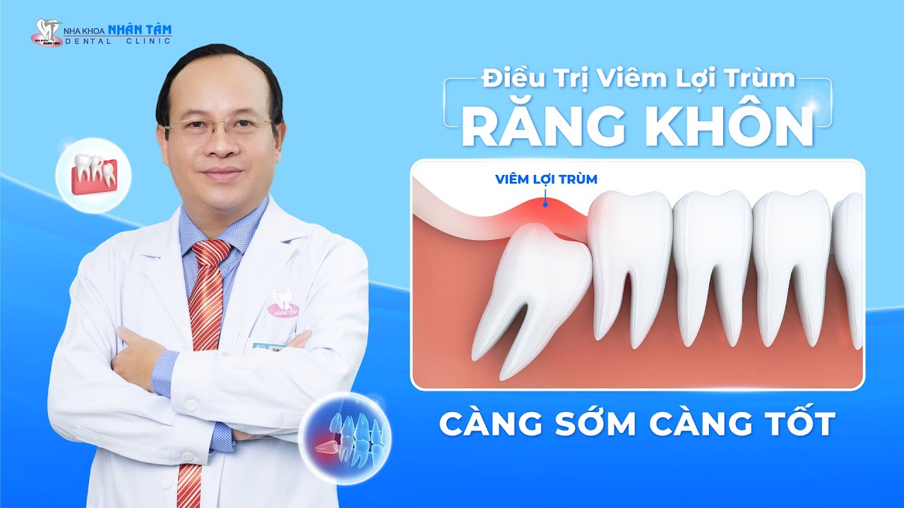 ĐIỀU TRỊ VIÊM LỢI TRÙM RĂNG KHÔN CÀNG SỚM CÀNG TỐT | NHA KHOA NHÂN TÂM