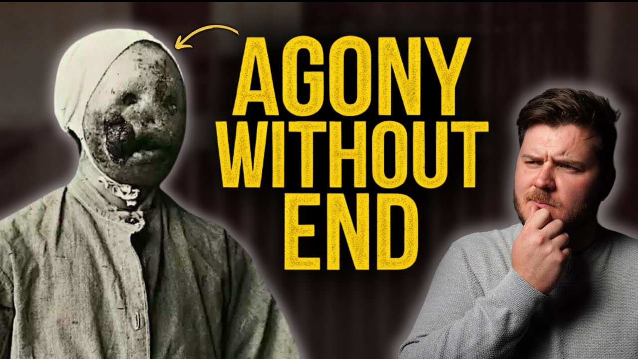 Leprosy's Dark History 🦠