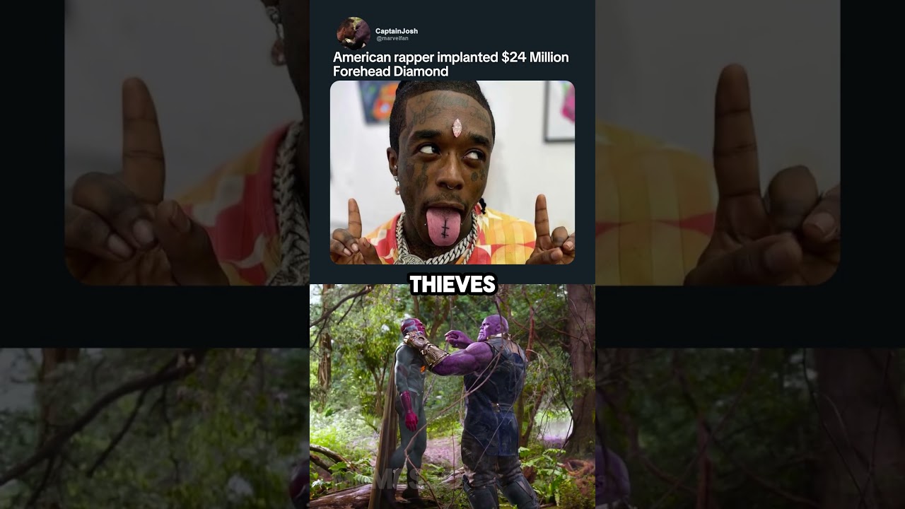 Lil Uzi Vert's Forehead Diamond 💎