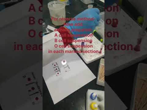 Forward and reverse blood grouping method. How to prepare cell suspension for reverse method? Next