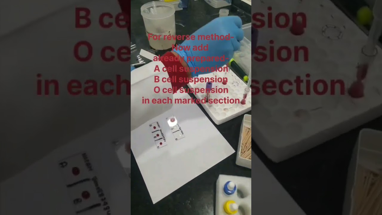 Forward and Reverse Blood Grouping Methods: Preparation of Cell Suspension for Reverse Method