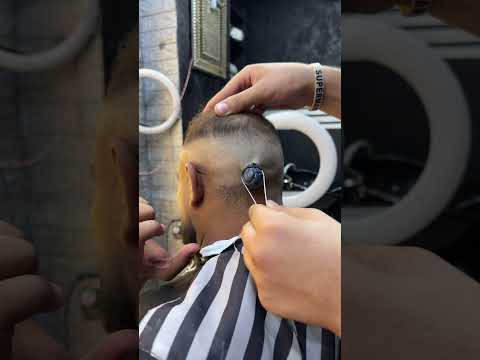 🥵✂️ ازالة الحبايه المتسلطنه بالايد #fyp #foryou #foryoupage #viral #barbershop #explore #barber