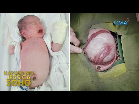 Sanggol, nagdadalang-tao?! | Kapuso Mo, Jessica Soho