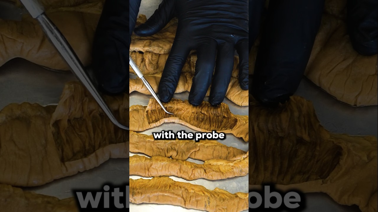 How Your Small Intestine Absorbs Food