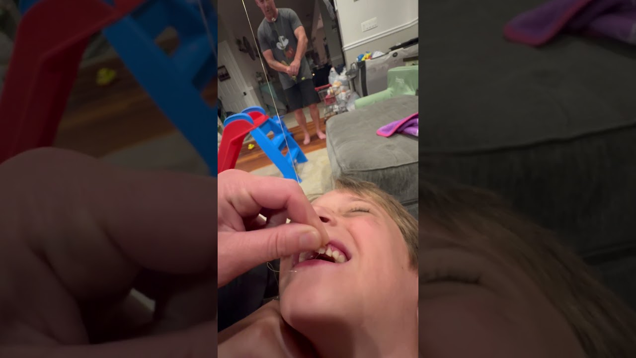 Safe Tips to Pull Out a Loose Tooth 🦷