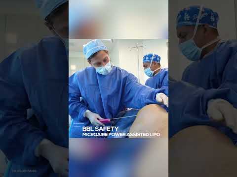 How to safely inject fat during a BBL! #plasticsurgery #shorts #bbl #liposuction #tummytuck