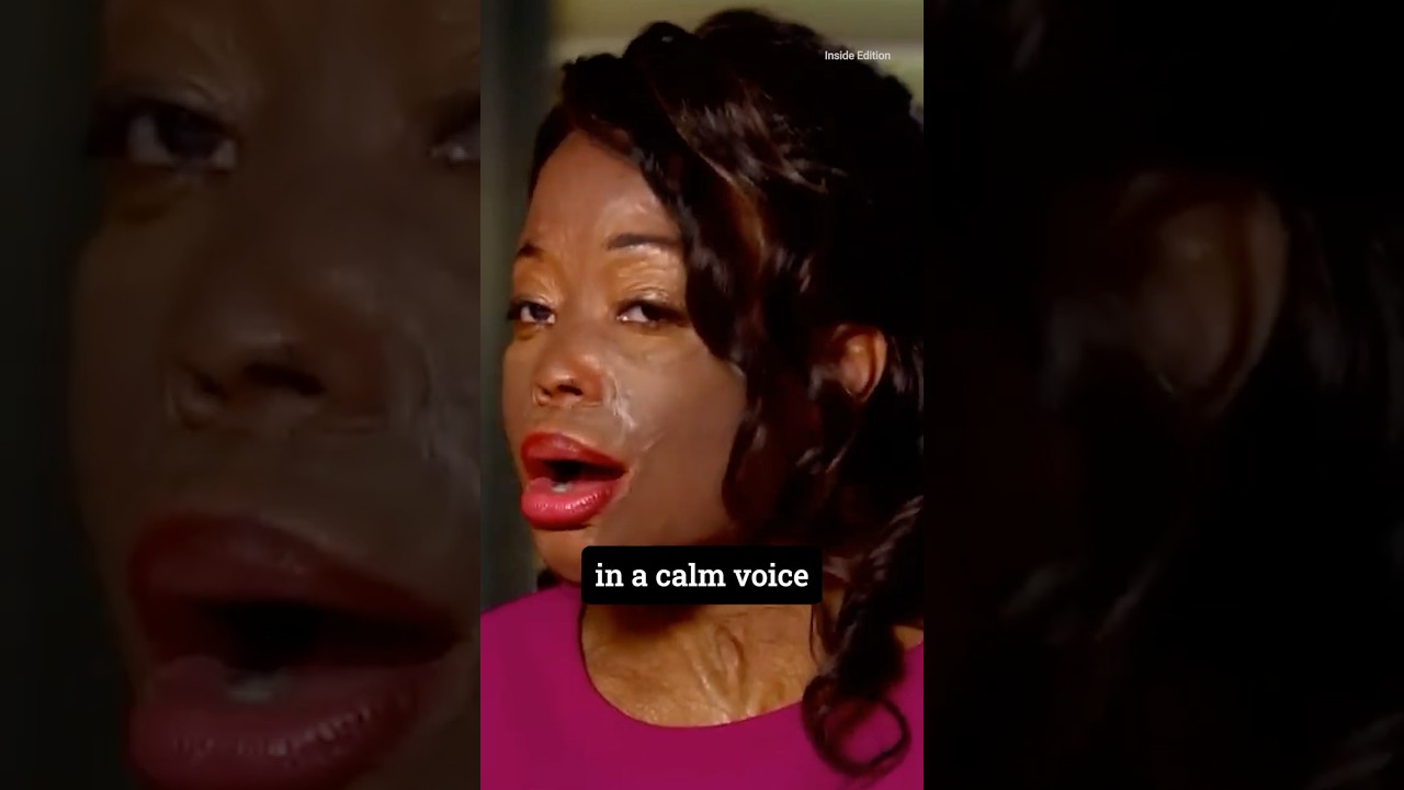 Survivor's Fight: How Acid Attack Victim Christy Sims Turned Tragedy Into a Movement 💪