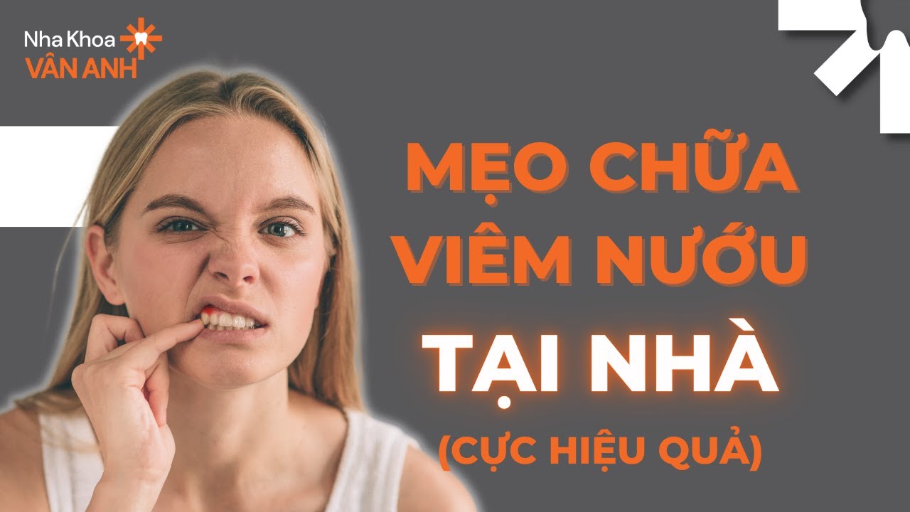 Mẹo chữa viêm nướu tại nhà hiệu quả 💡