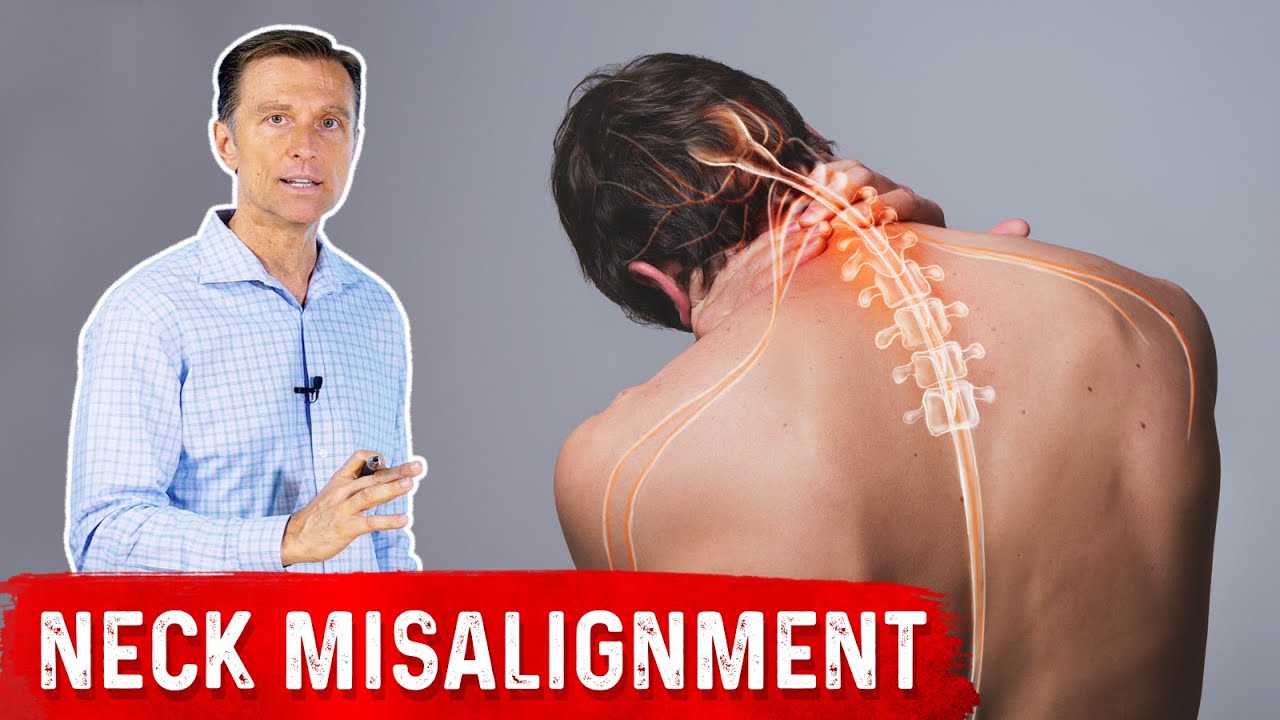 Understanding Chronic Neck Misalignment: It's Not Just About the Neck
