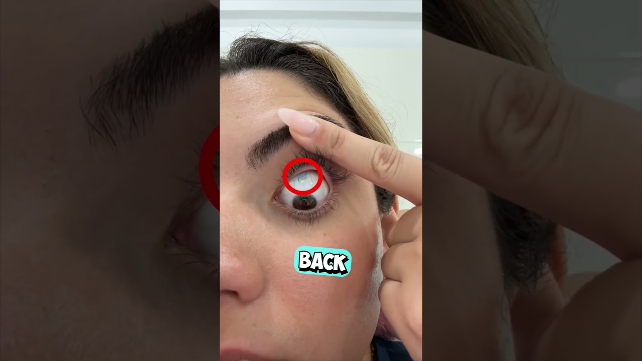 How to Remove Stuck Contact Lenses π³