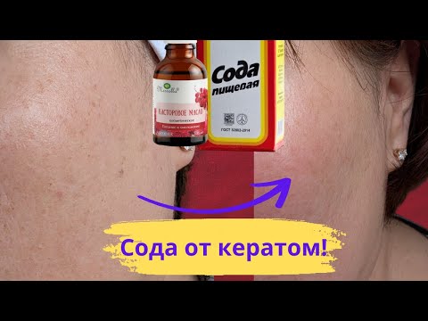 Сода и масло для удаления кератом и выравнивания кожи