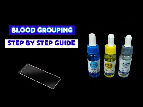 How to do blood grouping- Slide method| |MEDICAL LABORATORY SCIENCE