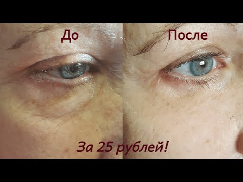 Доступное аптечное средство для омоложения кожи