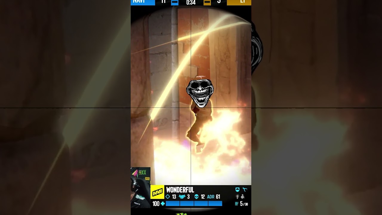 Watch XANTARES Play Counter-Strike Live 🎮