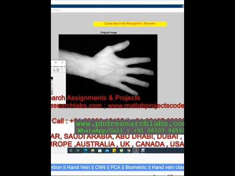 Hand vein classification CNN _ Hand Vein _ Dorsal Vein recognition _ CNN _ PCA _ Biometric - MATLAB