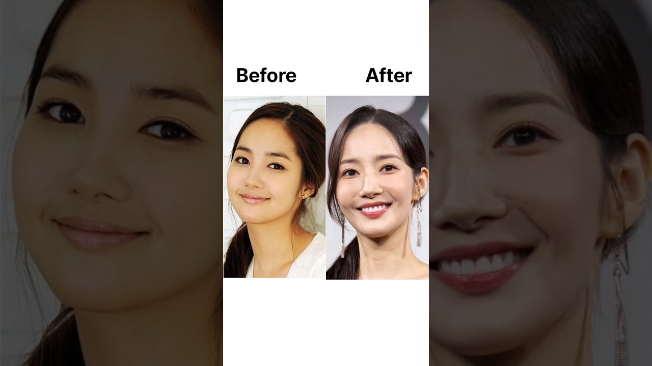 K-Celebs' Plastic Surgery Fails 📸