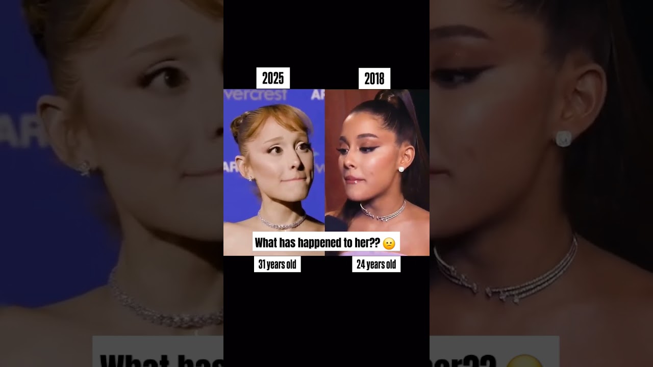 Ariana Grande's Health & Weight Loss Journey 🎤