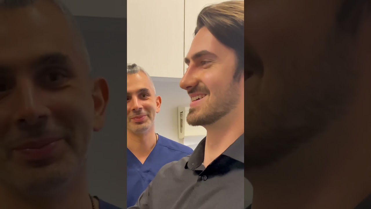 AMAZING MALE Rhinoplasty Before & After! #rhinoplasty #beverlyhills #facialplasticsurgery