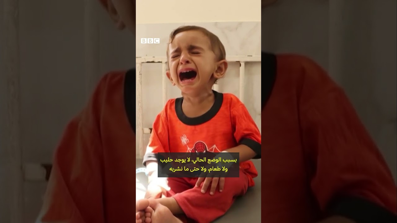 وفيات أطفال غزة بسبب سوء التغذية 🩺