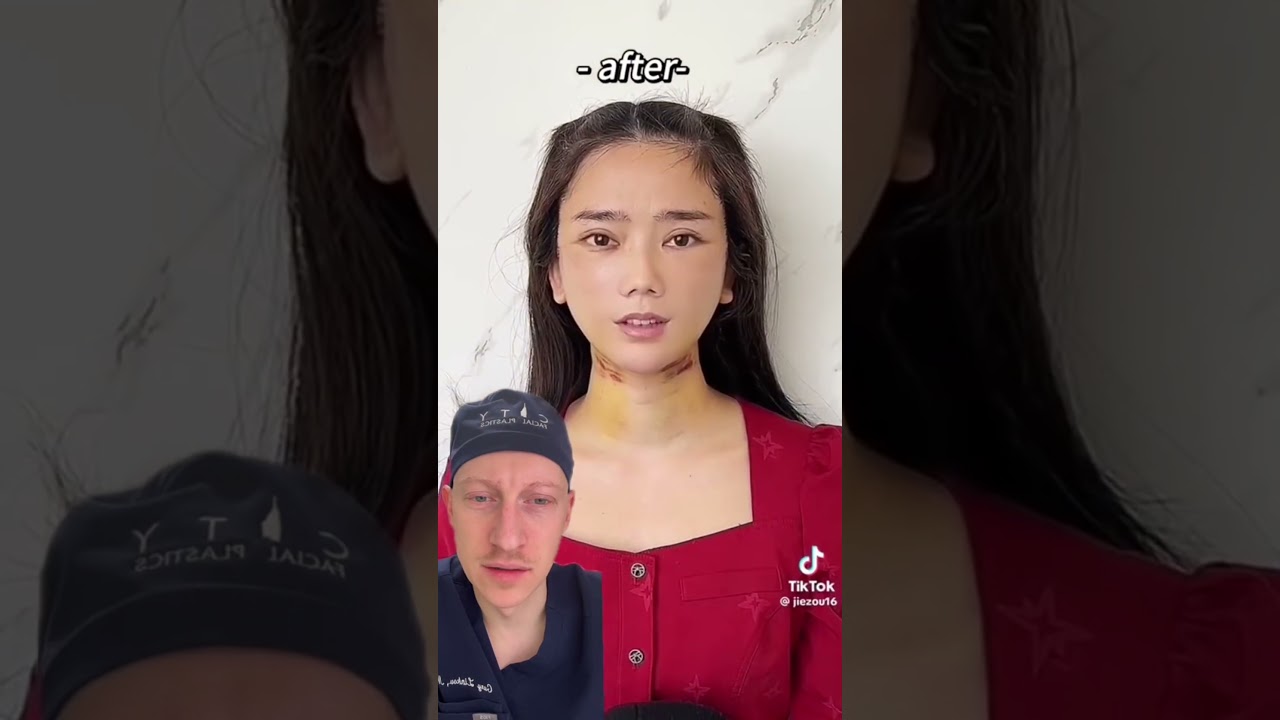 Shocking TikTok Plastic Surgery Results | Plastic Surgeon Reacts