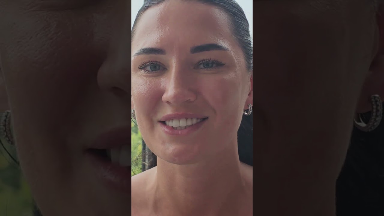 Лучшее лечение зубов винирами в Анталии 🌟 — Сделайте свою улыбку идеальной!