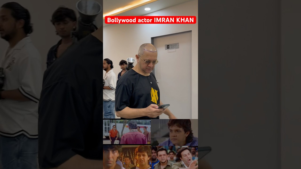 Imran Khan's Hair Transplant Journey ✨