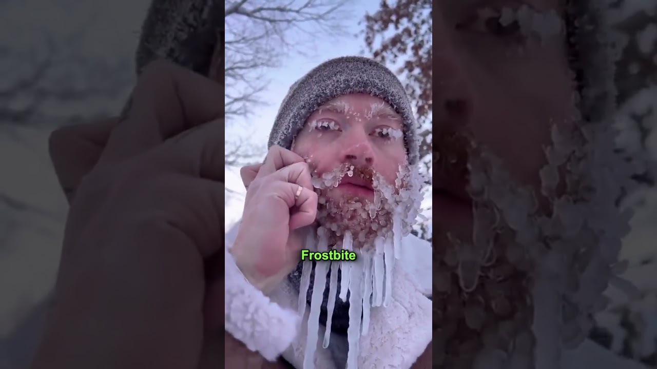 Surviving Extreme Cold 🥶 #shorts