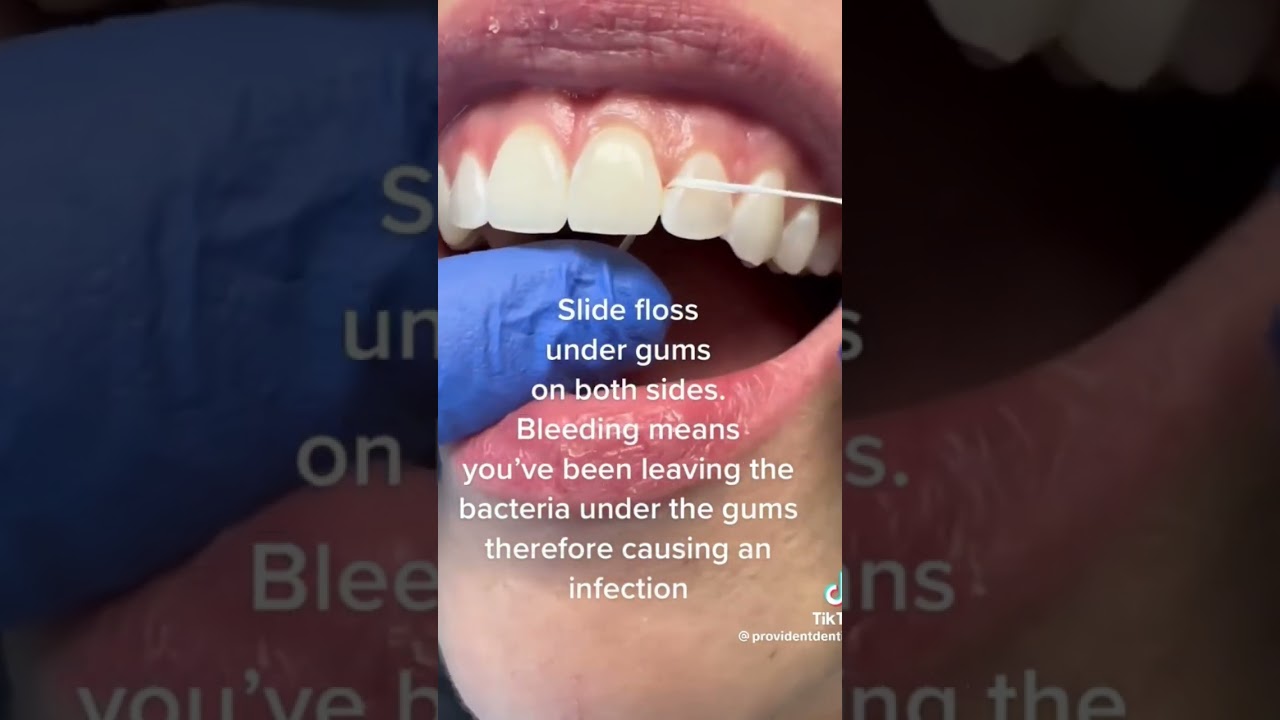 Are You Flossing Correctly? 🦷
