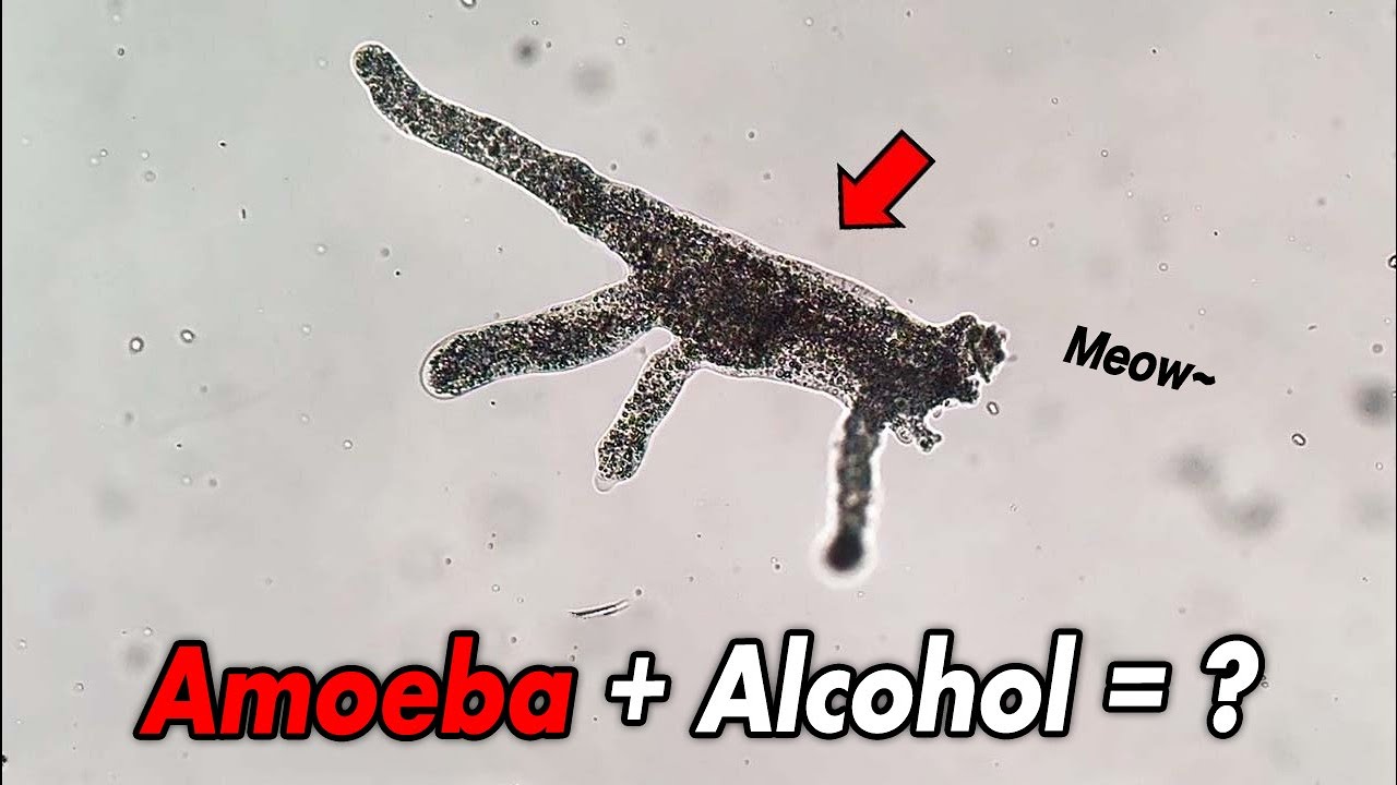 The Movement of a Living Amoeba Is Truly Shocking