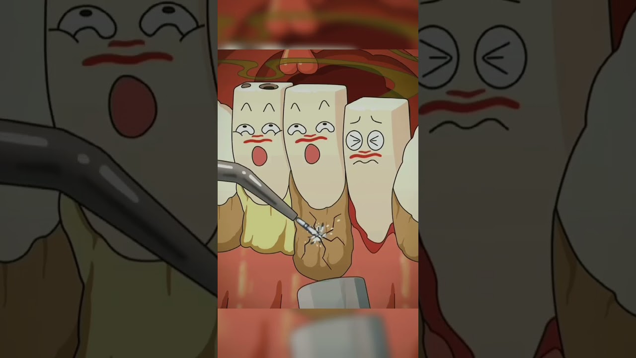 Cao Răng hay Vôi Răng: Điều Gì Đúng? 🦷