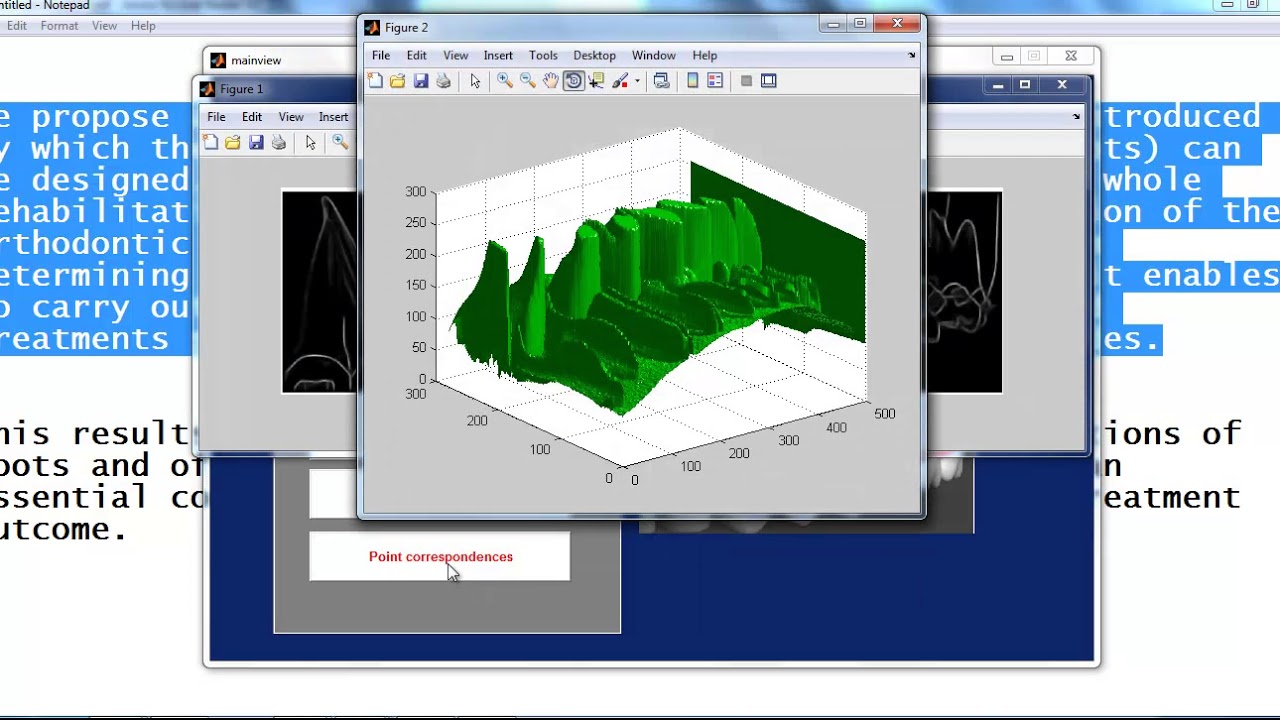matlab project ideas for beginners | matlab thesis ideas for beginners