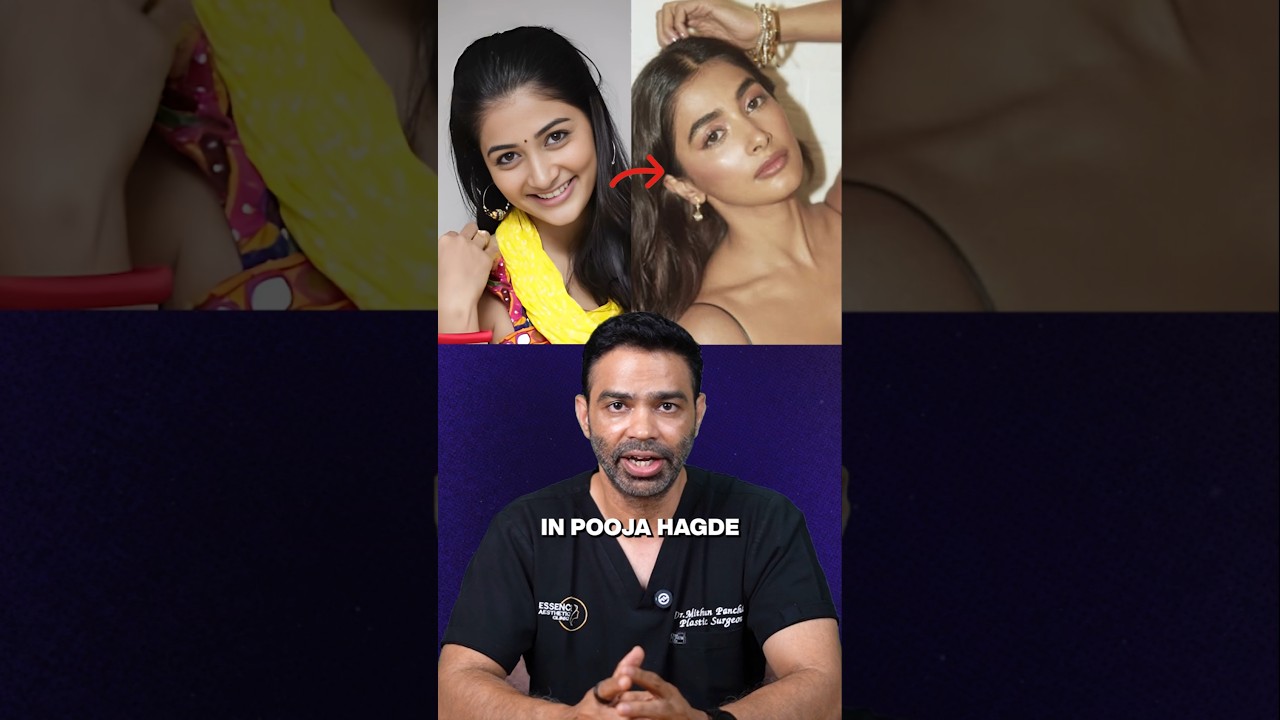 Pooja Hegde's Plastic Surgery Transformations Revealed ✨