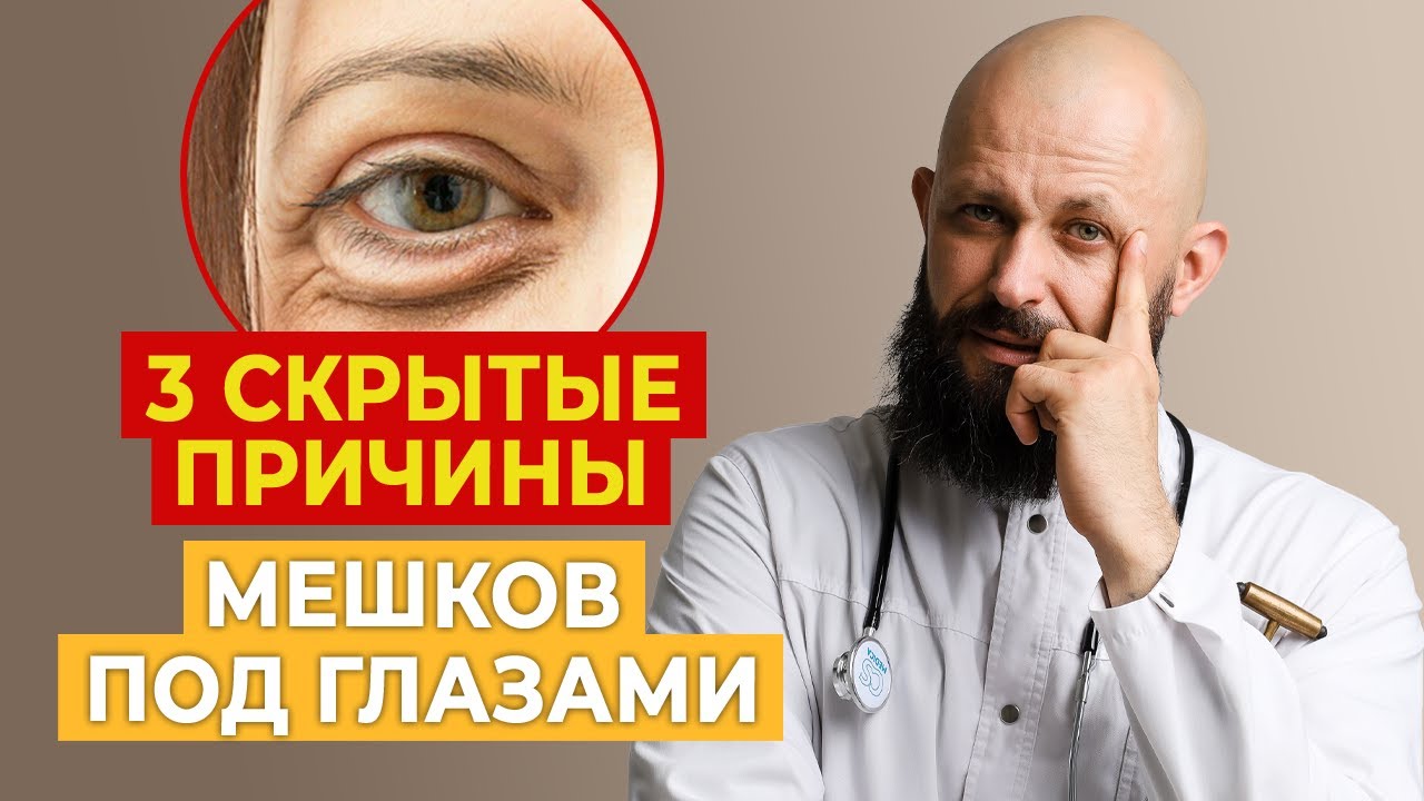 Убрать мешки под глазами за минуту: 3 метода ✨