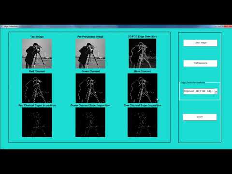 Final Year DIP & Thesis Projects | Matlab Code