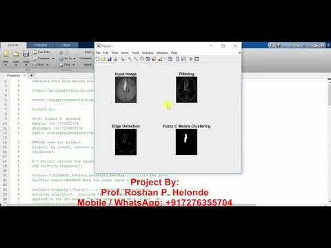 Image Segmentation Using Fuzzy C Means Clustering Matlab Source Code