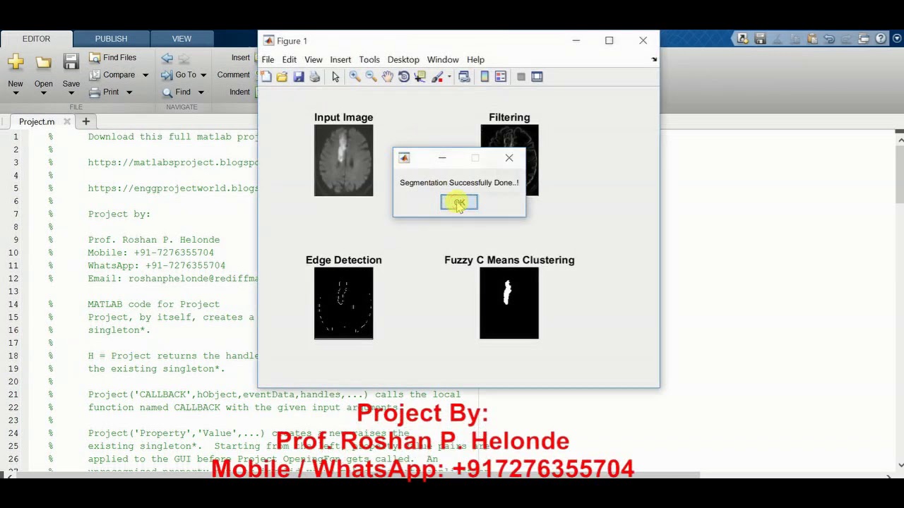 Image Segmentation with Fuzzy C-Means Clustering in MATLAB - Source Code