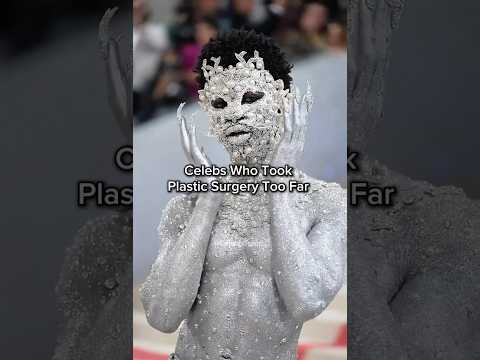 You Won’t Believe Their Transformations! 😱🤯 #celebrity #hollywood #plasticsurgery