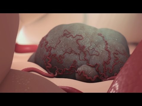 Cancer Treatment: Chemotherapy Overview