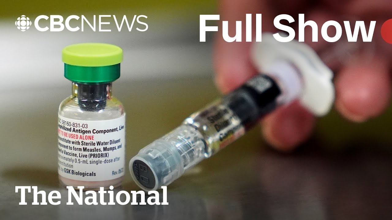 Canada Loses Measles Elimination Status π¨π¦