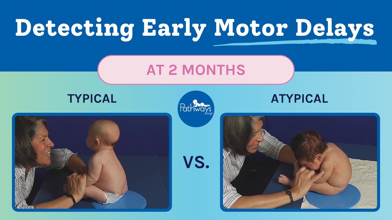 2 Month Typical & Atypical Development | Baby Motor Development Exam