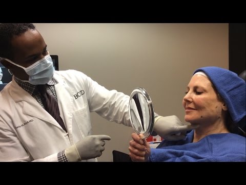 Dr. Charles Boyd on CBS: Benefits of Facial Plastic Surgery