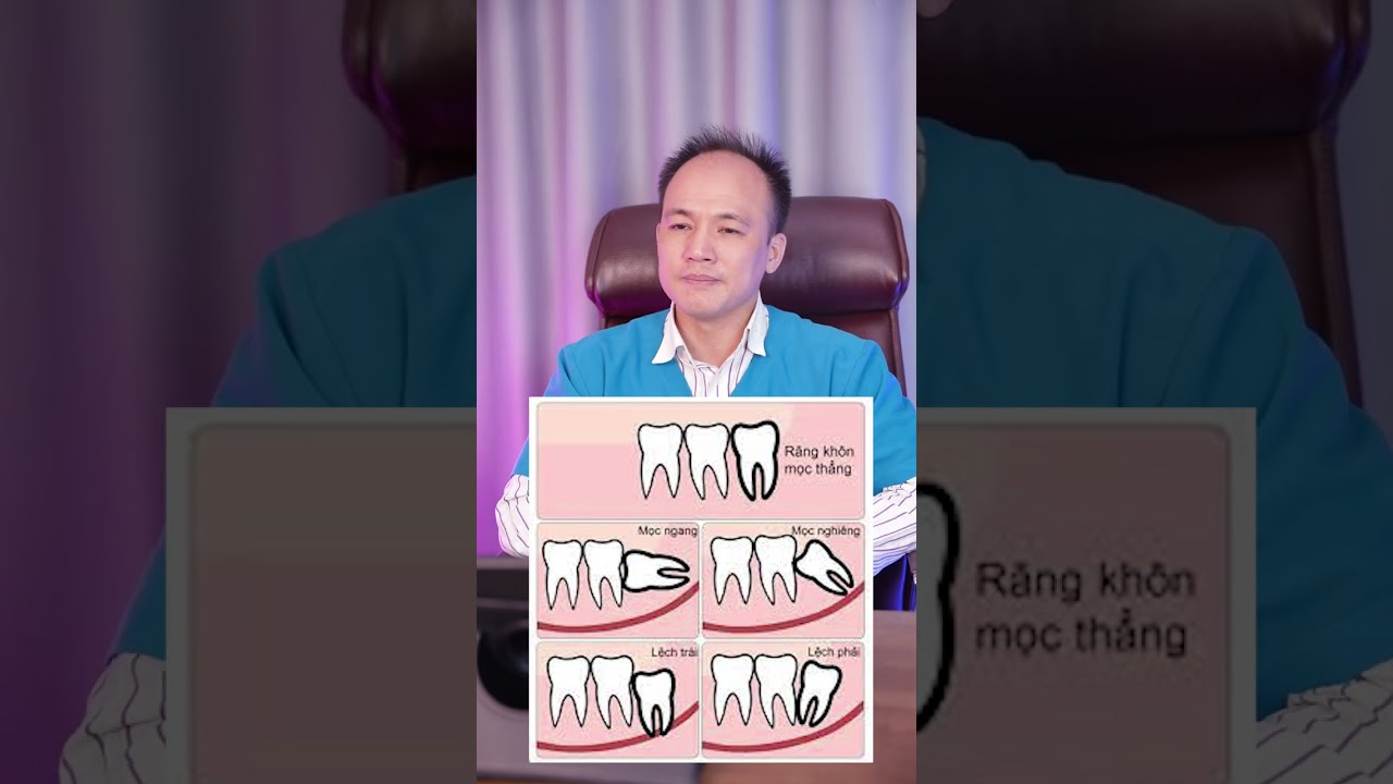 Ai Cũng Cần Nhổ Răng Khôn 🦷 | Nha Khoa Minh Châu