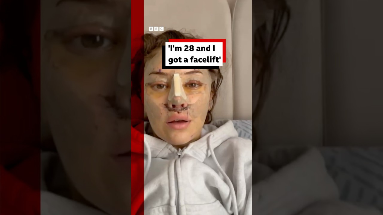 "I'm 28 and I got a facelift". #Facelift #PlasticSurgery #BBCNews